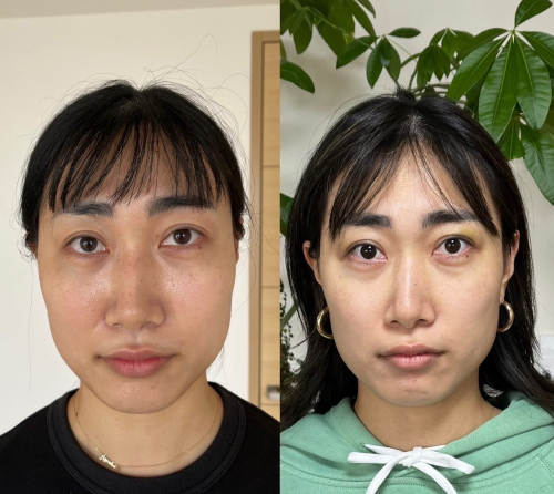 アピール写真