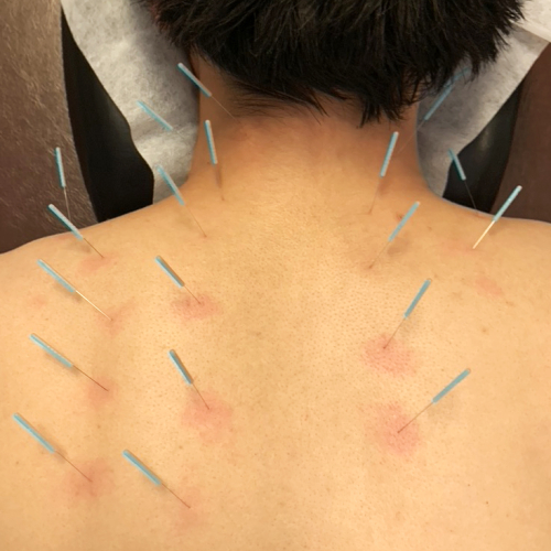 アール鍼灸治療院・南青山のこだわりポイント