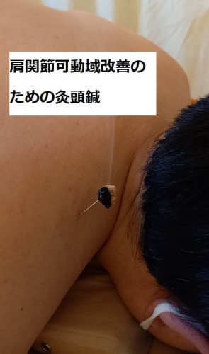 鹿行鍼灸院のこだわりポイント