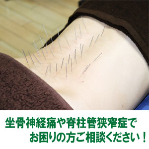 ゆず鍼灸治療院のこだわりポイント