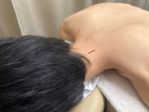 吉祥寺名倉堂鍼灸接骨院のこだわりポイント