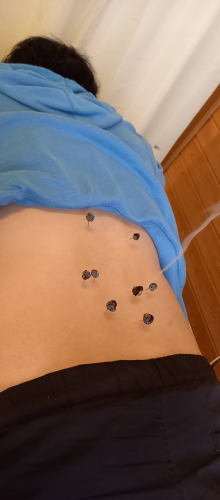 鹿行鍼灸院のこだわりポイント