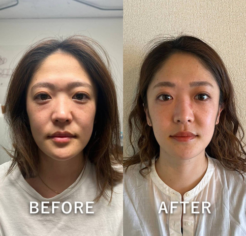 彩り はりきゅう ルート治療認定院のこだわりポイント
