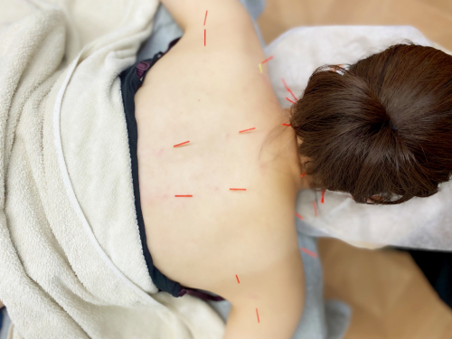 鍼灸サロンZouzou(ずず) のこだわりポイント