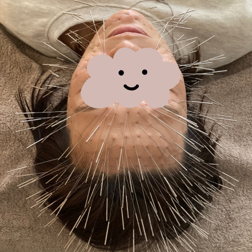 アピール写真