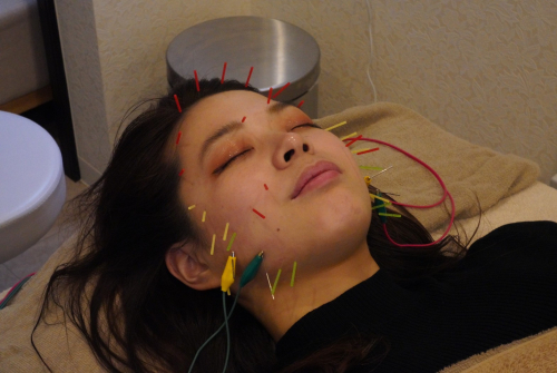 鍼灸ルミナスのこだわりポイント