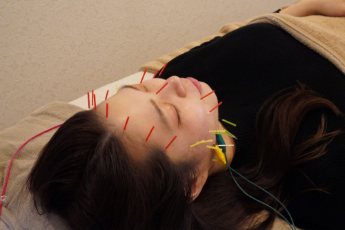 鍼灸ルミナスのこだわりポイント