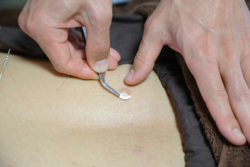 下米田はりきゅう治療院のこだわりポイント