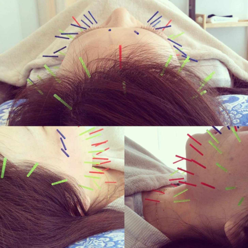 川端七条鍼灸整体院のこだわりポイント
