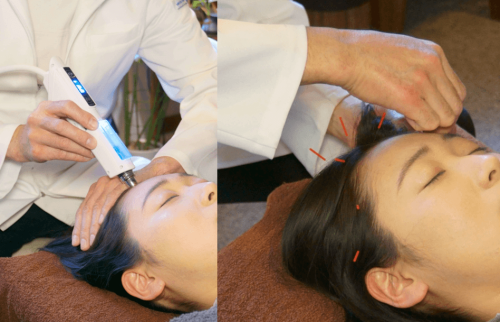 薄毛・抜け毛専門の鍼灸治療院レメディのこだわりポイント