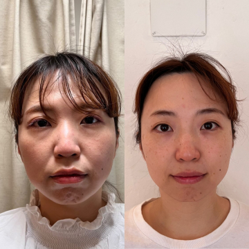 ルート鍼治療【土佐】もりさわ治療院のこだわりポイント
