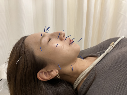 武庫之荘駅前鍼灸接骨院のこだわりポイント