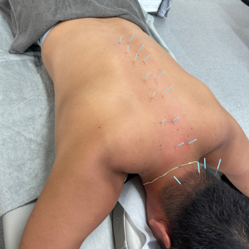 鍼灸院整骨院ティップ春日院のこだわりポイント