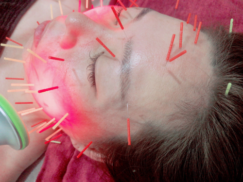 Ｓｙｕｏｎ朱音　鍼灸院のこだわりポイント