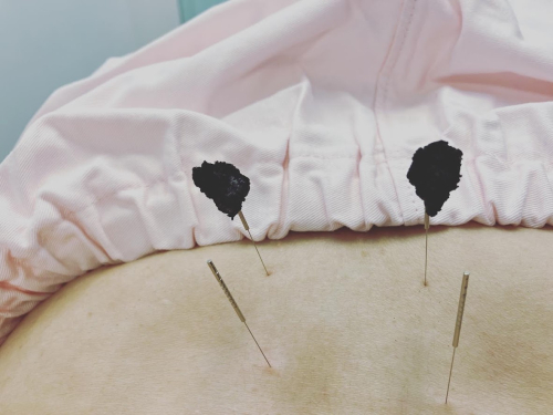 かきざわ鍼灸指圧マッサージ院のこだわりポイント