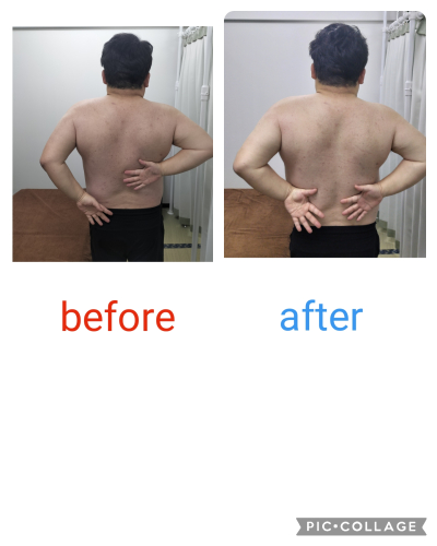 【ルート治療専門鍼灸院】鍼侍のこだわりポイント