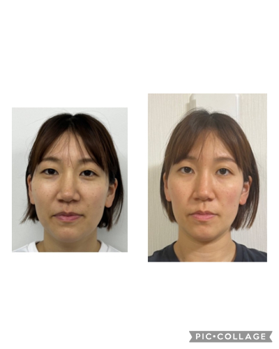 【ルート治療専門鍼灸院】鍼侍のこだわりポイント