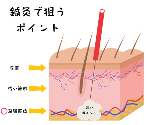 よこまち鍼灸整骨院のこだわりポイント