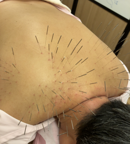 鍼灸・整体 かんなり治療院のこだわりポイント