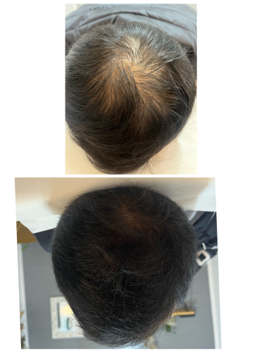 鍼灸salon ASENS ルート治療院のこだわりポイント