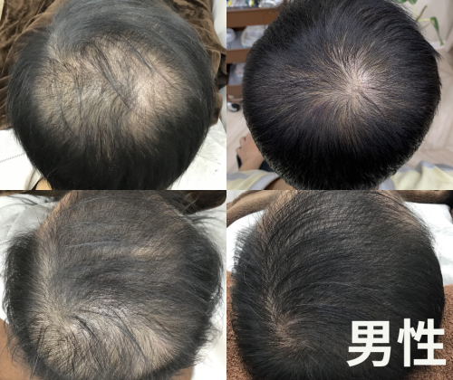 美容鍼・薄毛専門 はりきゅっと鍼灸院のこだわりポイント