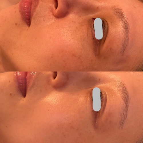 円山漢祥院　円山接骨院のこだわりポイント