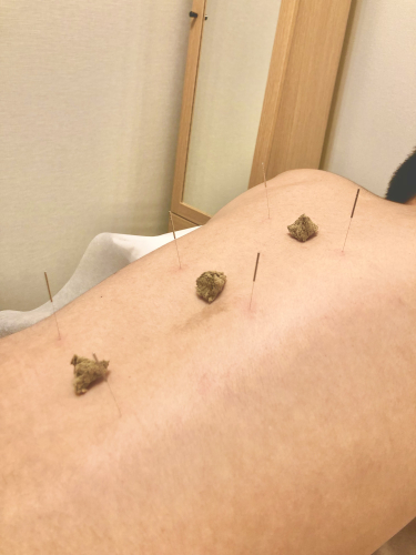 大森くれよん鍼灸院のこだわりポイント