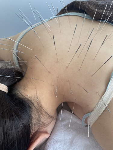 maryu358鍼灸・整体院のこだわりポイント