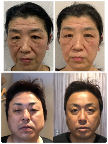 鍼灸整体Salon Acuwill【ルート治療✖️自己治癒整体】のこだわりポイント