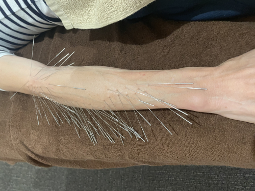 鍼灸整骨院拓【ルート治療院】のこだわりポイント