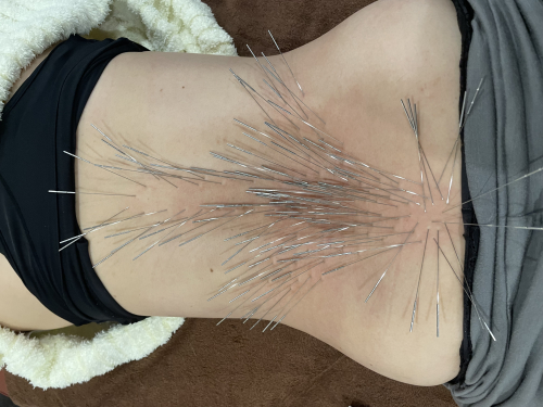 鍼灸整骨院拓【ルート治療院】のこだわりポイント