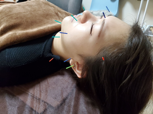 鍼灸Salon KUKUNA 小平店のこだわりポイント