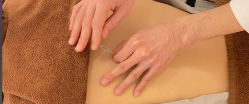 鍼灸TSUKIMORIのこだわりポイント