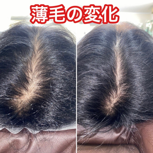 青葦(あおい)治療院【薄毛・パニック障害・適応障害】のこだわりポイント