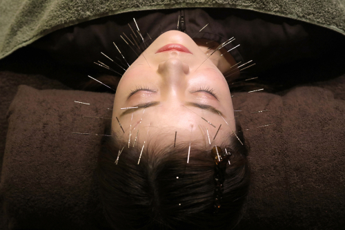 ORIENT THERAPY ルート治療・鬼神美容鍼(ルート治療ベース)・電気美容鍼・刺さない極美鍼・難聴特化型鍼サロンのこだわりポイント