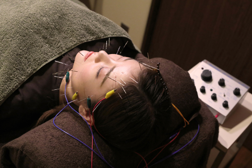 ORIENT THERAPY ルート治療・鬼神美容鍼(ルート治療ベース)・電気美容鍼・刺さない極美鍼・難聴特化型鍼サロンのこだわりポイント