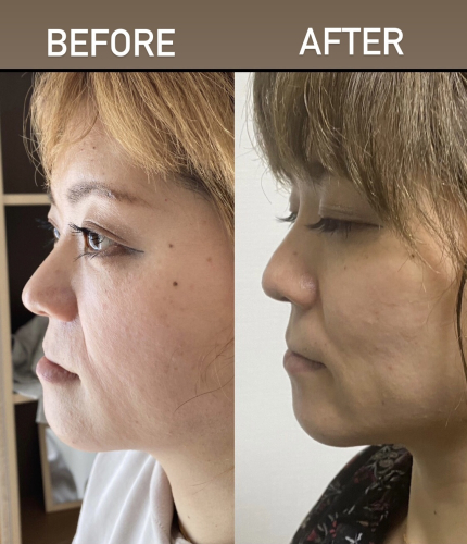 Iris鍼灸マッサージ上野院【ルート治療専門】のこだわりポイント