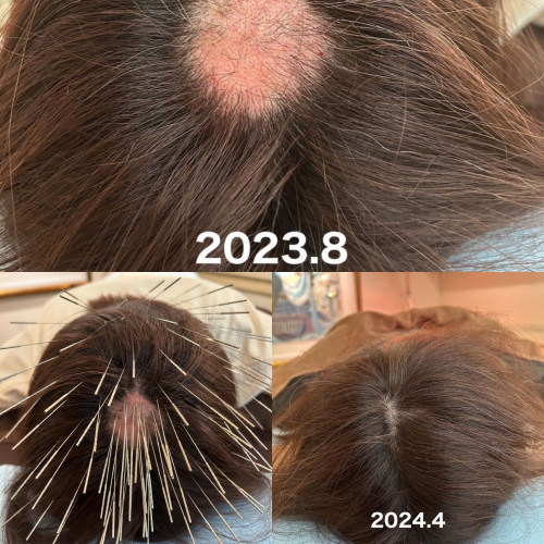 Iris鍼灸マッサージ上野院【ルート治療専門】のこだわりポイント