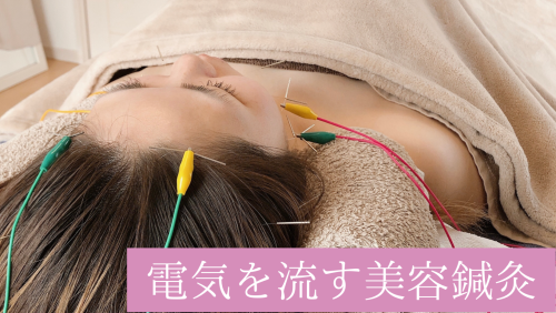 鍼灸　臨床こぼれ話 鍼灸臨床こぼれ話 3 |本 | 通販 | Amazon