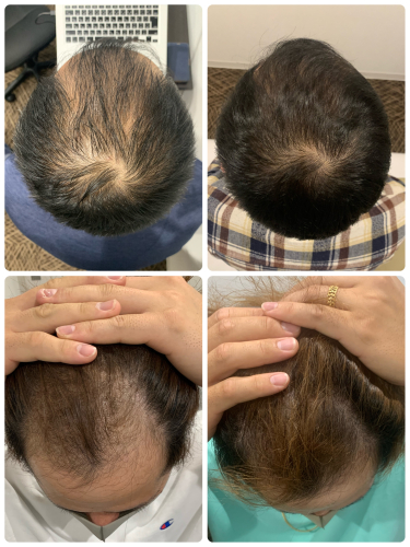 鍼灸整体Salon Acuwill【ルート治療✖️自己治癒整体】のこだわりポイント