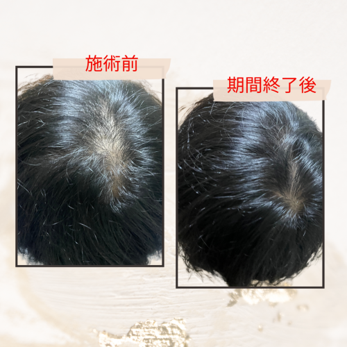 鍼灸サロンRestoreのこだわりポイント