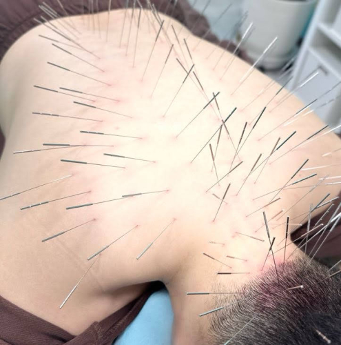 美身堂えいち鍼灸院 〜ルート治療・美容鍼〜のこだわりポイント