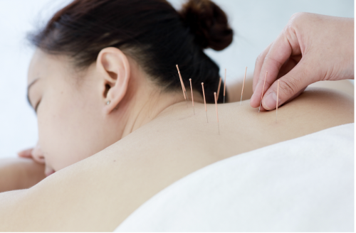 訪問鍼灸えりーのこだわりポイント