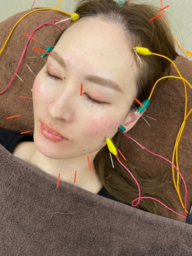 美容鍼・薄毛専門 はりきゅっと鍼灸院のこだわりポイント