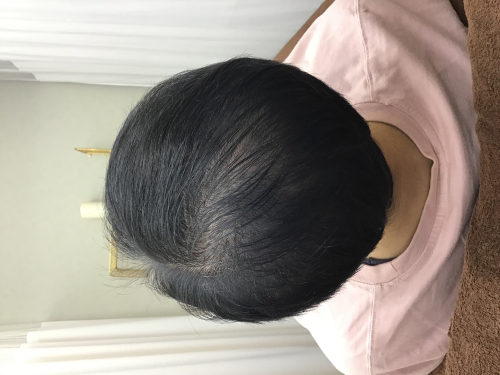 美容鍼・薄毛専門 はりきゅっと鍼灸院のこだわりポイント
