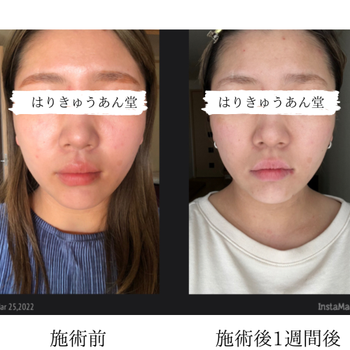はりきゅうあん堂【ルート治療|女性専用】のこだわりポイント