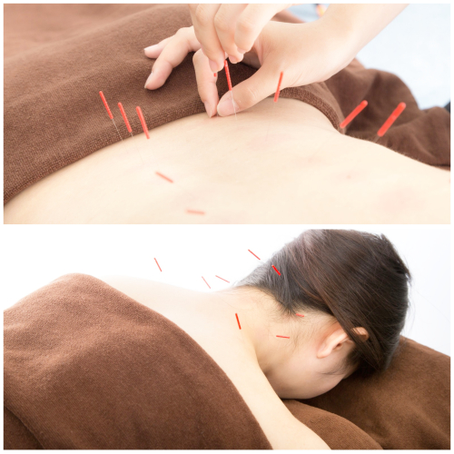 なかむら鍼灸整骨院のこだわりポイント