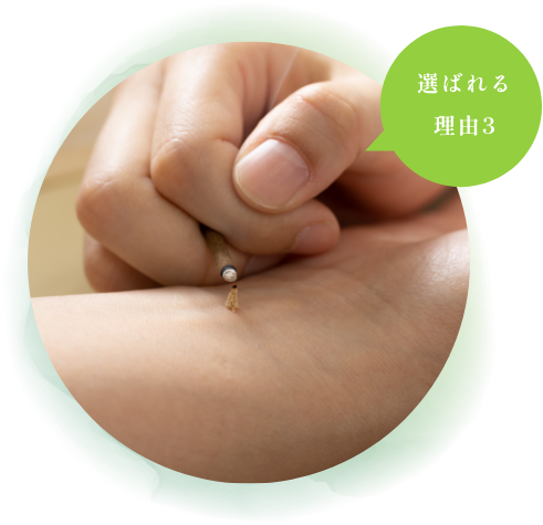 松山鍼灸整骨院のこだわりポイント