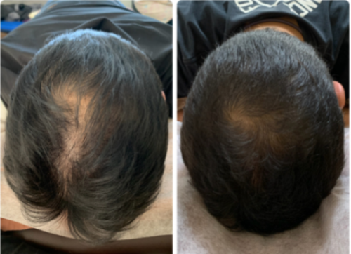 鍼処MUCALINDAのこだわりポイント