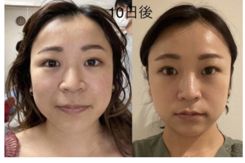 鍼処MUCALINDAのこだわりポイント